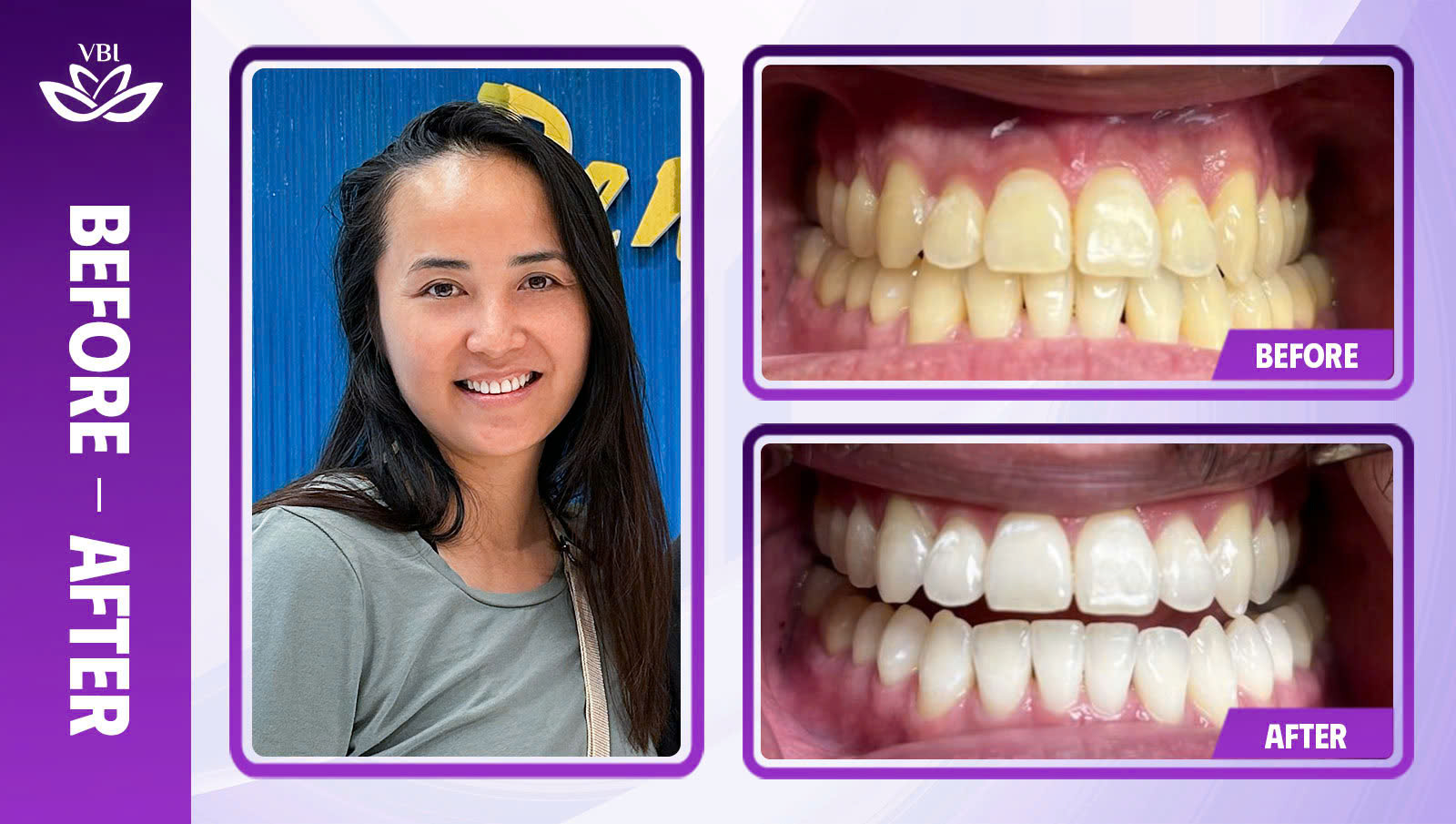 z7336235844575_05cf735f9826928077842e9e5fcf3ea7