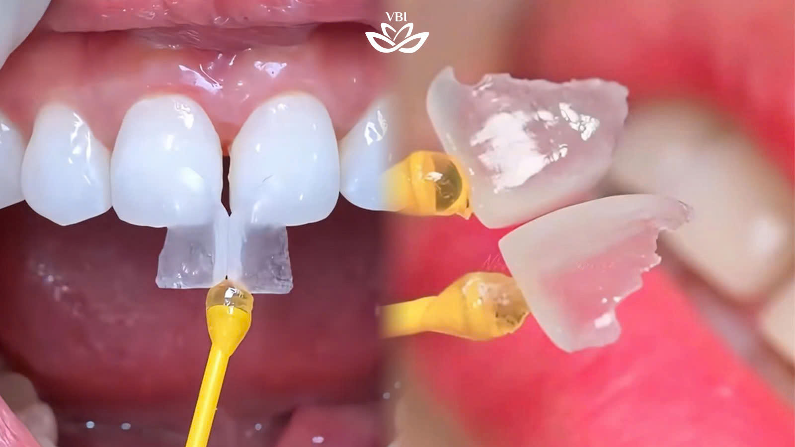 z7342750486060_d2a7401a18fd0f27fd0e1fa12fd52b6a