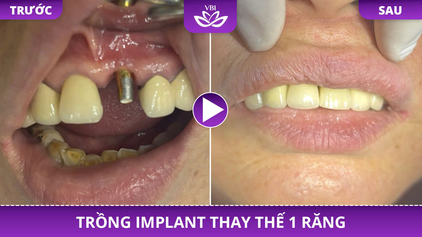 z7352583885334_7fed9efe8f152bed43b82f53063e62be