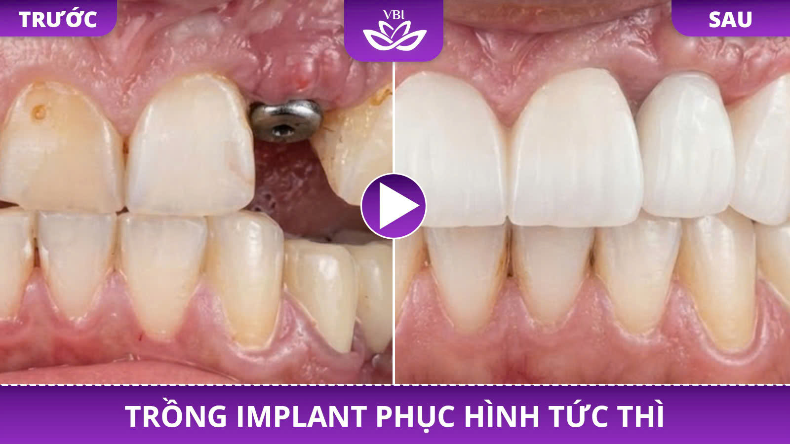 z7352583885523_e688da3df5fa8d74799f8e059100ec5d