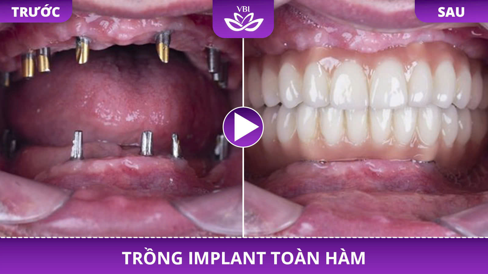 z7352583930756_55ed39ffba1b63bc5882ae9aa139a270