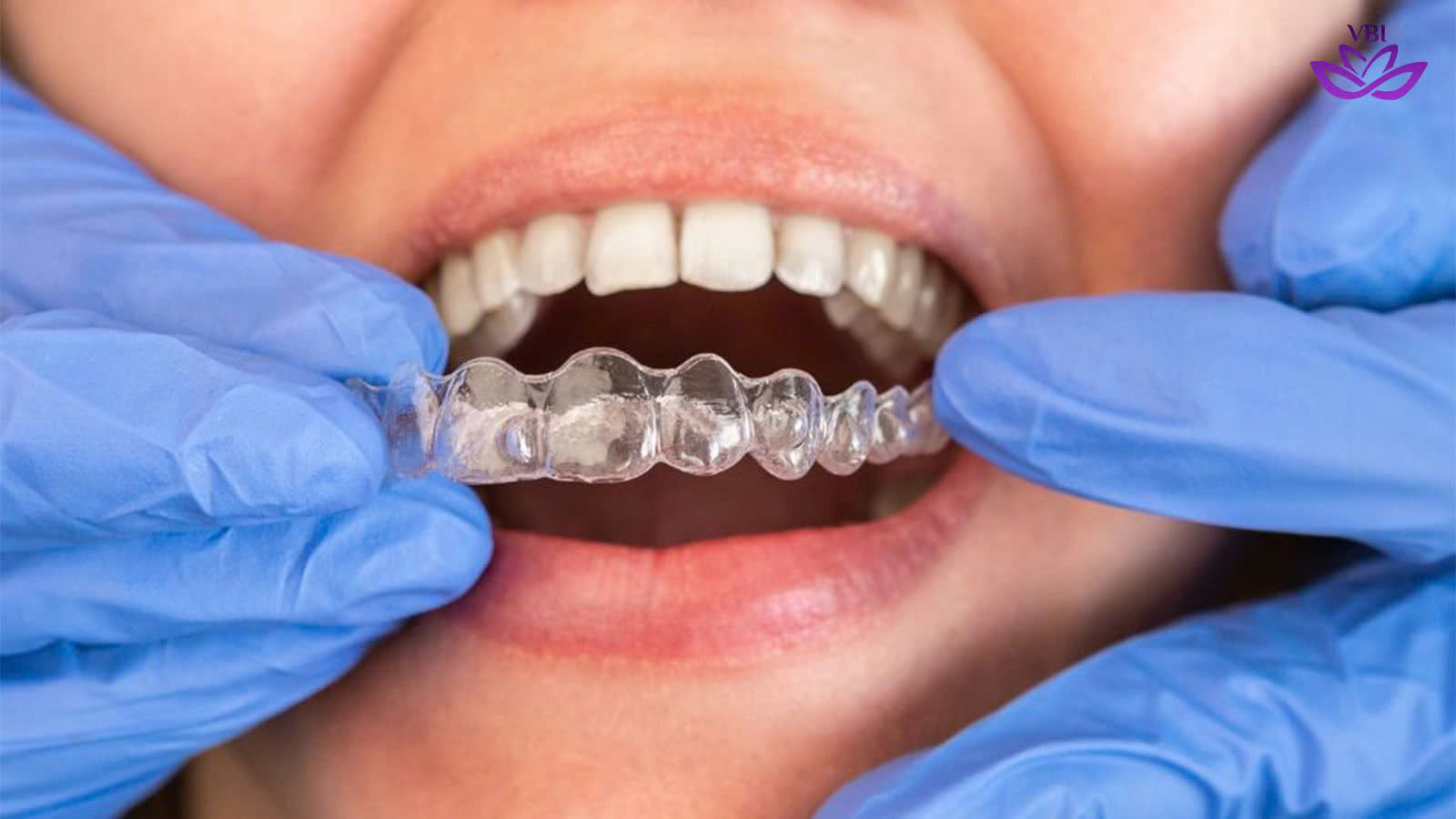 z7352703332060_99efd57d365a28fe48354936b7c95495