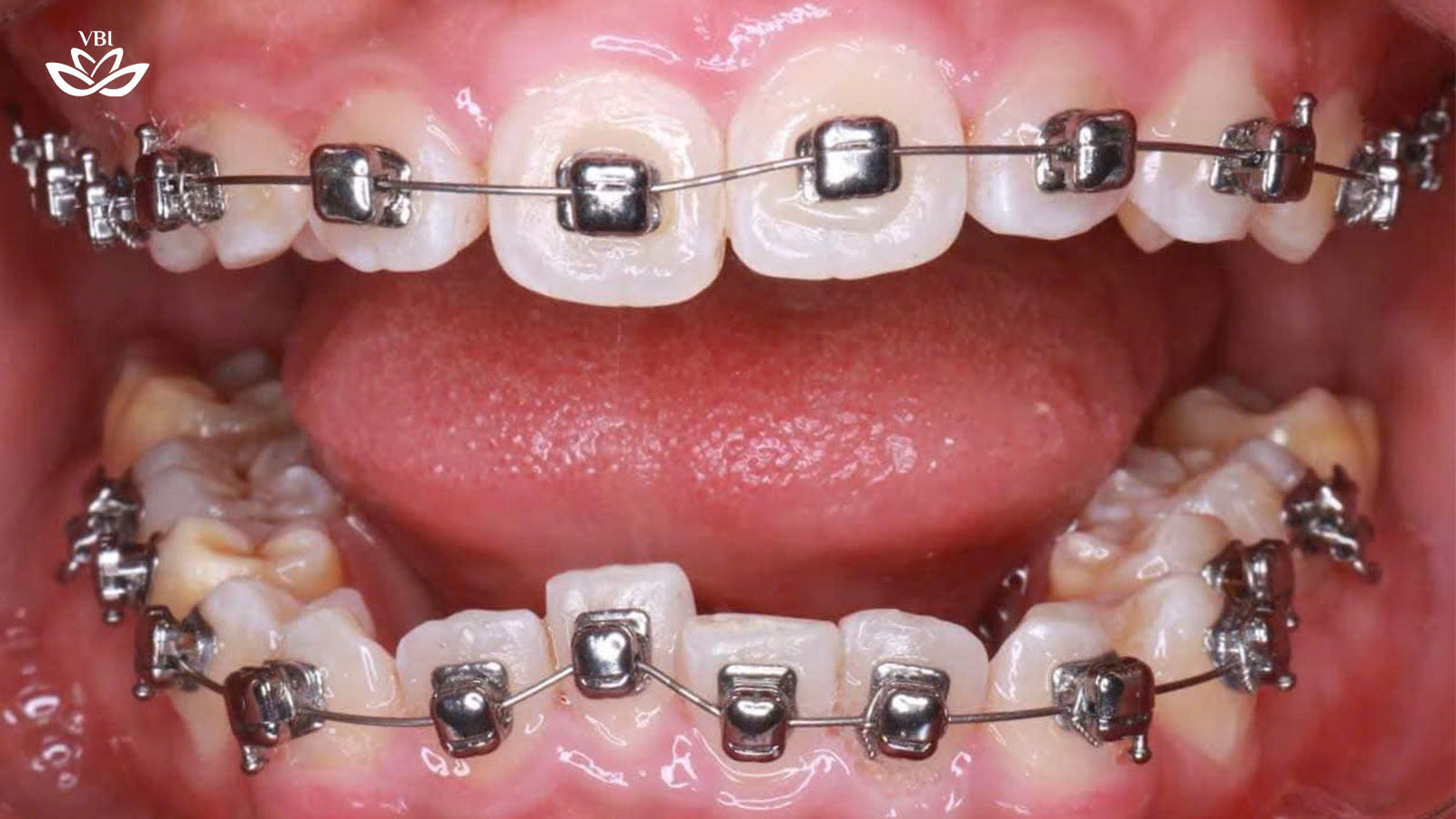 z7359419964074_0fdbfbd788afeee2f943de80b7d3f47d