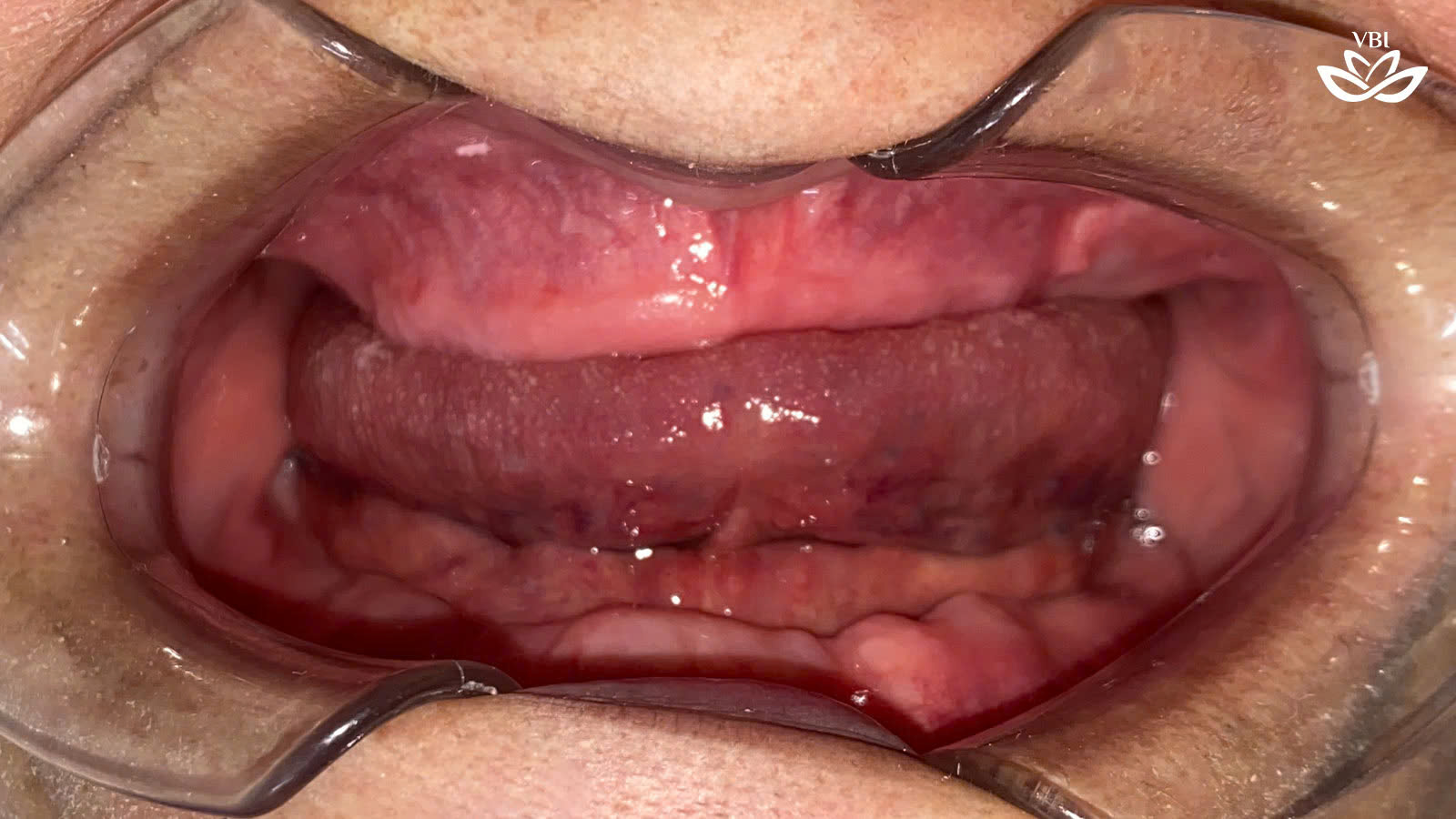 z7469677902822_f51c1b4877e82332689fdf390401992e