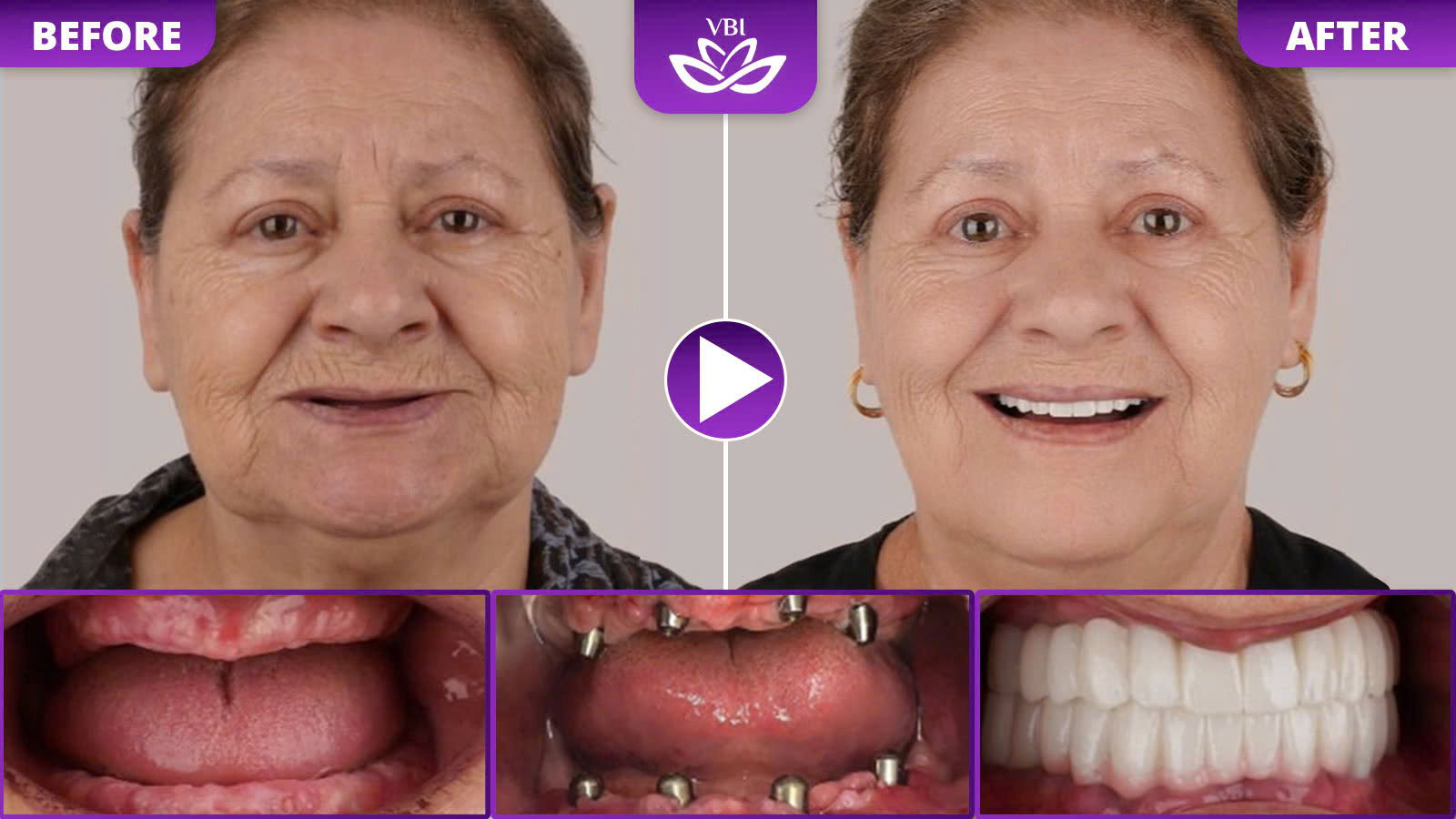 z7469678236207_3d745d846378b9383aba59f63db318ee