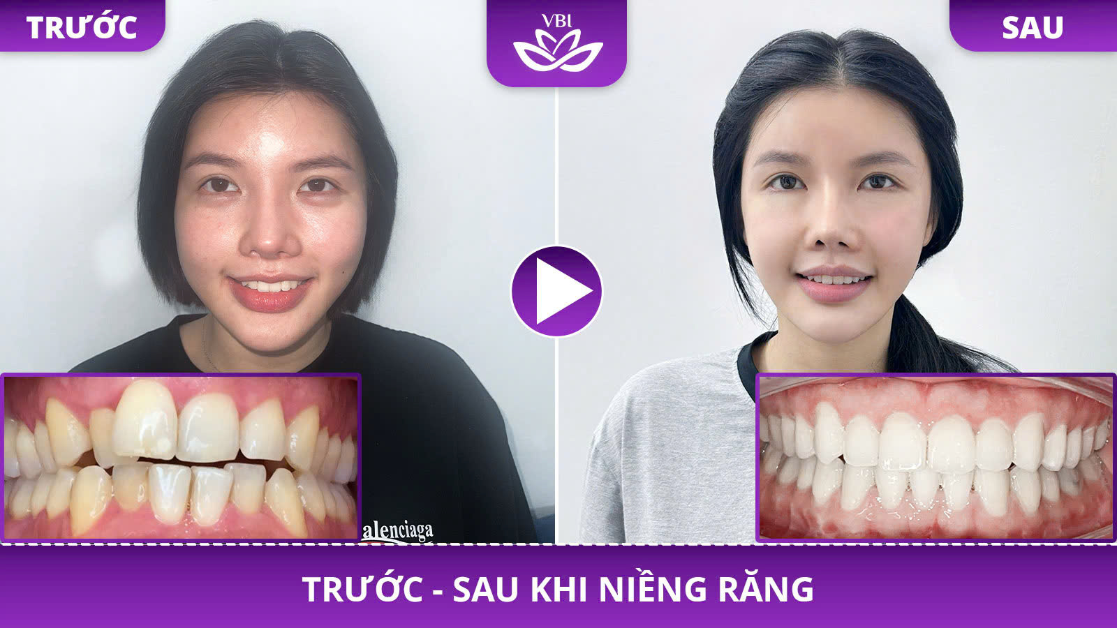 z7582651716790_9b35ebd92f28890ff698094e7497caea