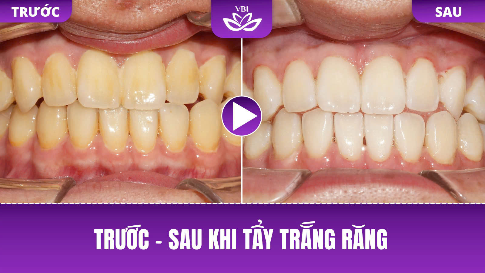 z7583172619534_5803c47b204c9d58786fddd38e91d4c3