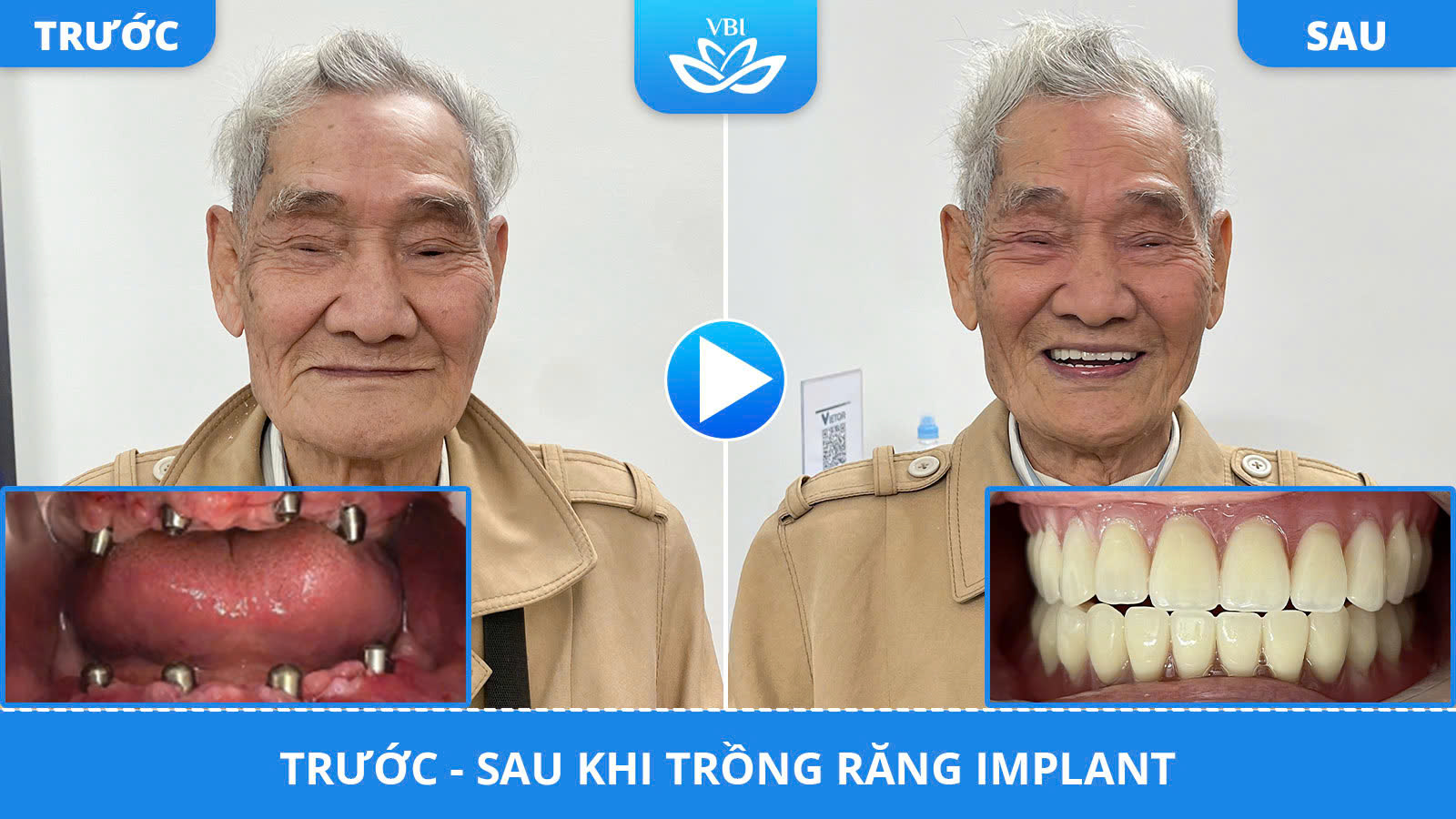 z7592705672686_85431887c5809088e217f2cc256d7b50