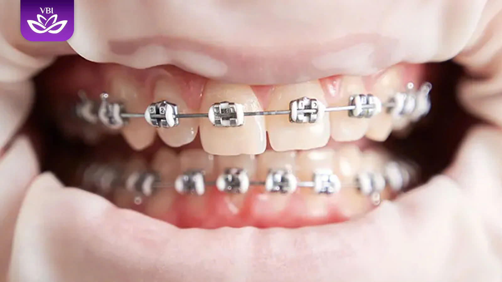 z7601717603510_94201ad2b2c423281960e5aa926546ff