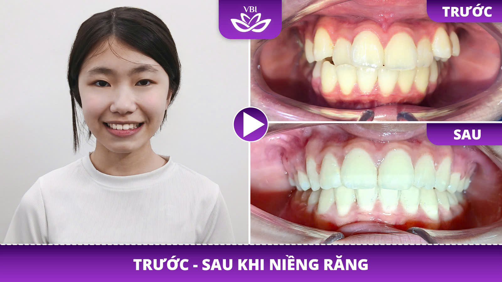 z7601717727123_e9d3b470bbf8b8e97f17f0bf1cae7c68